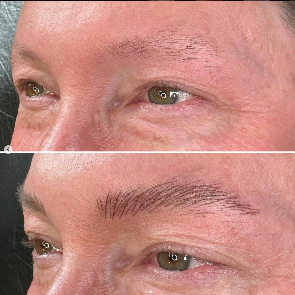 Eyebrow enhancement before/after